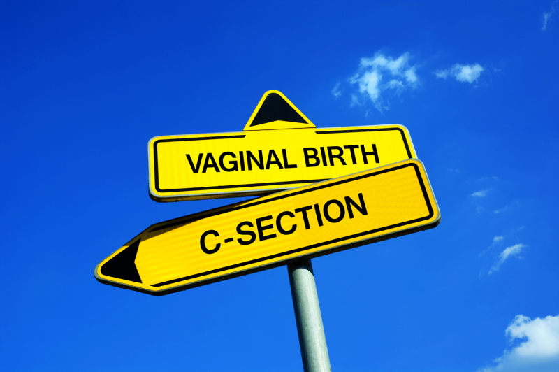 Vaginal Delivery or Caesarean Section?